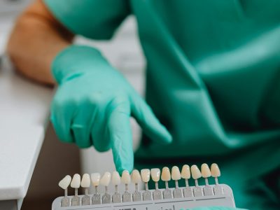 Dental professional using shade guide for teeth color selection in clinic setting.